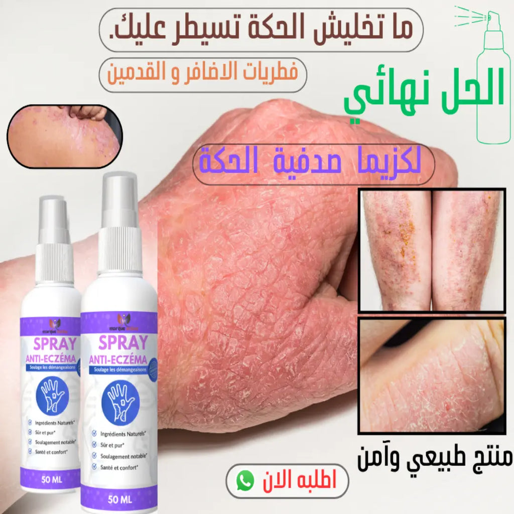 Spray Anti-Eczéma 50 ml – Apaise, Hydrate & Protège la Peau