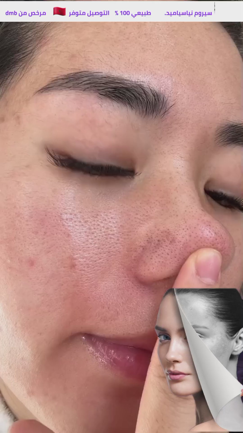 Sérum Niacinamide – Unifie le Teint & Réduit les Imperfections