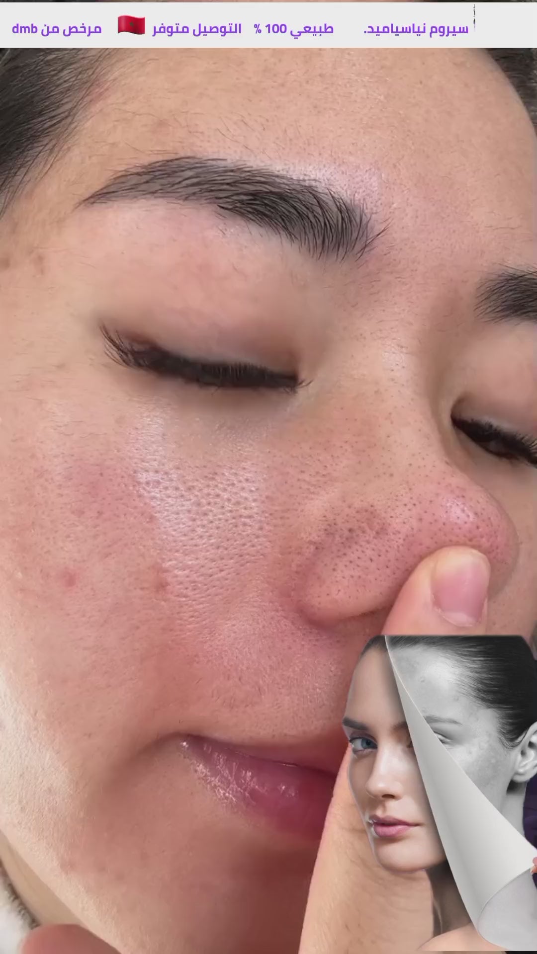 Sérum Niacinamide – Unifie le Teint & Réduit les Imperfections